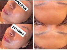 お悩みにしっかりアプローチしていきます。しっとり艶やかな肌へ