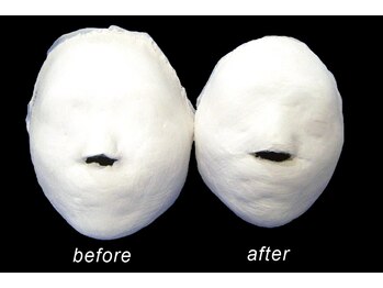 カン コルギセラピー 横浜(KAN)/オルチャンコルギ（小顔）