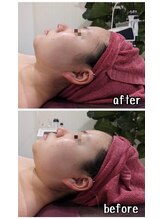 ファビリス 仙台ロフト店(FAVILIS)/【フェイシャル】ハイパー2回目