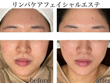 ル クール(Le Coeur)の写真