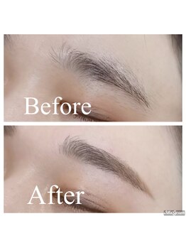 エムデコビューティ(M-DecoBeauty)/下がり眉から平行眉へ☆
