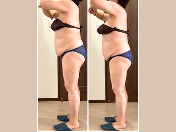 リライブ 亀有店(Re:Lives)/全身ビフォーアフター【痩身】