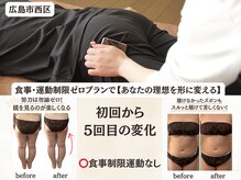 ヨサパーク シアー(YOSA PARK sheer)