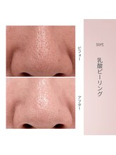 リアン(Lien)/50代ビフォーアフター