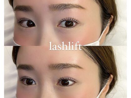 エピ(epi)の写真