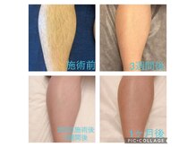 メルシー ドゥ(merci do)の雰囲気（ビフォーアフター）