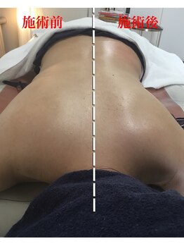 リセット(Reset.)/深層筋リンパ/ before → after