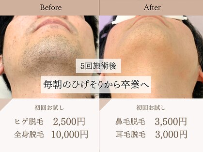 エクレ(EKURE)の写真