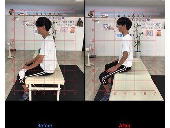 ストレチックス 近江八幡店/before/after