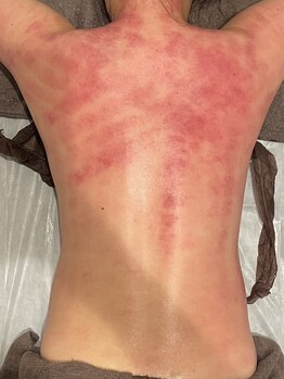 エクラ(eclat)の写真/【高リピート率】メリハリのあるくびれを手に入れたい方必見!肩こり改善や全体的なサイズダウンも叶う◎