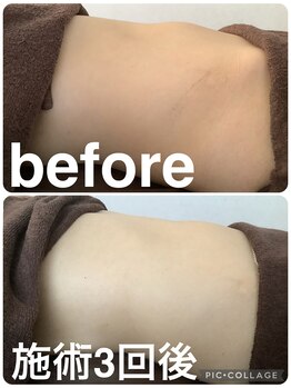 ギンザアール(GINZA R.)/