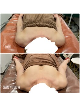 ロココ 大宮店(Rococo)/ふんわりバストアップ