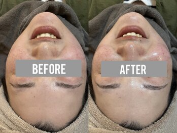 ビーマジック(Be Magic)/保湿 毛穴洗浄!