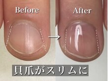 リリー/貝爪の変化