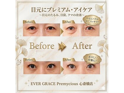 エヴァーグレース プレミシャス 心斎橋店(EVER GARACE Premycious)の写真