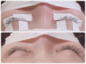 アイビューティー リコ ギンザ(eye beauty LICO ginza)/リペア