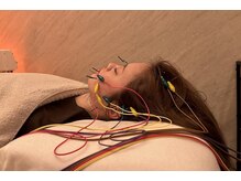 デルタエヌピー63+(δnp63+)/お客様施術例【小顔/薬院/福岡】