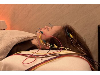 デルタエヌピー63+(δnp63+)/お客様施術例【小顔/薬院/福岡】