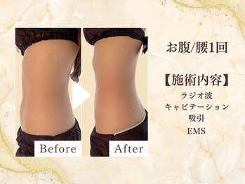 ミスティア(mistia)/【セルフエステBA】お腹