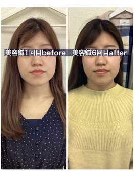 ハリサロンドオフ 堺東店(hari salon de off)/お客様before→after