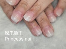 プリンセスネイル(Princess nail)/深爪矯正ベーシック自爪風ツヤ