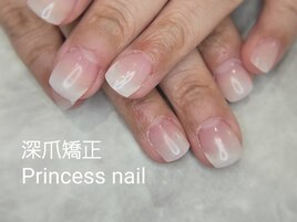 深爪矯正ベーシック自爪風ツヤ