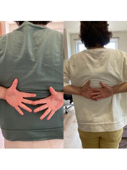 全身歪み調整 つなぎ/肩の痛みにしっかりとアプローチ