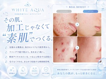 ホワイトアクア 北堀江店(WHITE AQUA)の写真/著名人も御用達！剥けない&ダウンタイムなし♪最先端ハーブピーリング/ララピールで最新韓国艶肌へ