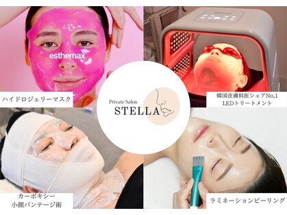 ステラ(STELLA)の写真