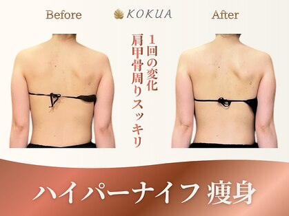 痩身専門店エステティックサロン コクア(KOKUA)の写真