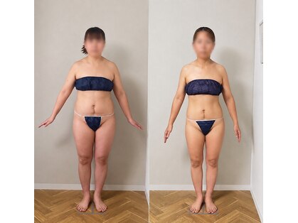 ラフォクシー(La.Foxy)の写真