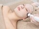 サロン ビュー(salon view)の写真/プラズマ照射で肌表面を殺菌＆細胞活性化◆ダウンタイム無のシミケア|お肌の透明感UP♪ぱっと明るいお顔へ