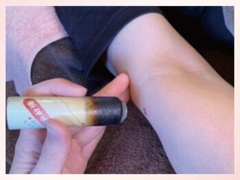 ラーナ(:ra-na)/お灸で筋肉を緩め不調緩和♪