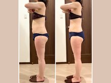 リライブ 亀有店(Re:Lives)/全身ビフォーアフター【痩身】