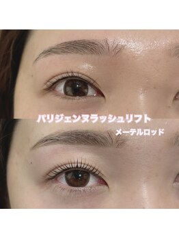 レディエント(Radiant)/パリジェンヌ/メーテルロッド