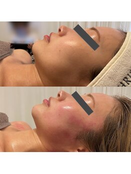 エクラ(eclat)/セルクラ