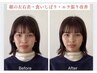 火/木限定!【食いしばり&小顔◎】整体×鍼×美容鍼×小顔90分¥17,400→ 4,000