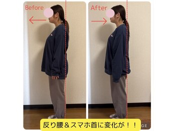 ベルフルール(Belle Fleur)/フェムケア矯正