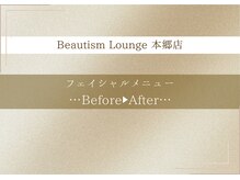 ビューティズムラウンジ 本郷三丁目店(Beautism Lounge)/フェイシャルビフォーアフター