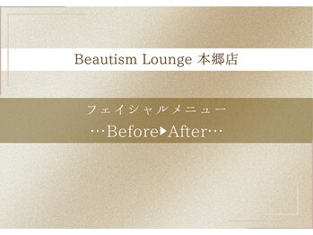ビューティズムラウンジ 本郷三丁目店(Beautism Lounge)/フェイシャルビフォーアフター