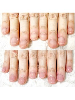 グレースレディ/(深爪/長さだし/フィルイン)