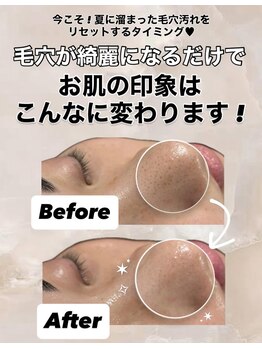 ビレボ マエバシ(BEREVO maebashi)/Before After