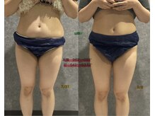 リボーン(REBORN)/産後ケアーダイエット