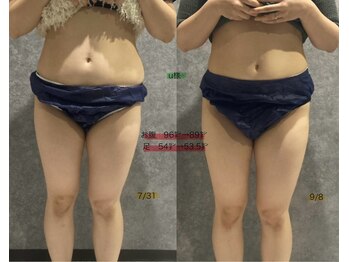 リボーン(REBORN)/産後ケアーダイエット