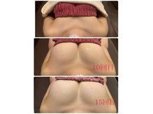 ロココ 錦糸町店(Rococo)の雰囲気（形・位置もしかっり造れるのでヌードバストも自信が持てます！）