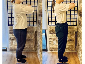 整体院リノベボディ(リノベBODY)/悩み：痩せたい［30代］