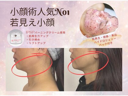 ソルニコン(Solnikon)の写真