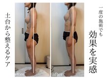 エイミー(Aimee)/バストだけでなく姿勢も整う