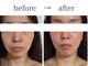 アールフェイシャル 郡山店(Rr.FACIAL)の写真