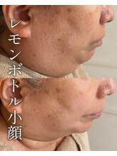 ハティア(hattia)&nbsp;レモン ボトル